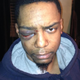 Taj Patterson after he was brutally beaten in the Williamsburg section of Brooklyn, N.Y., in December 2013
YouTube screenshot